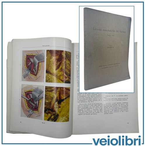 Lesioni traumatiche del bacino - lesioni,